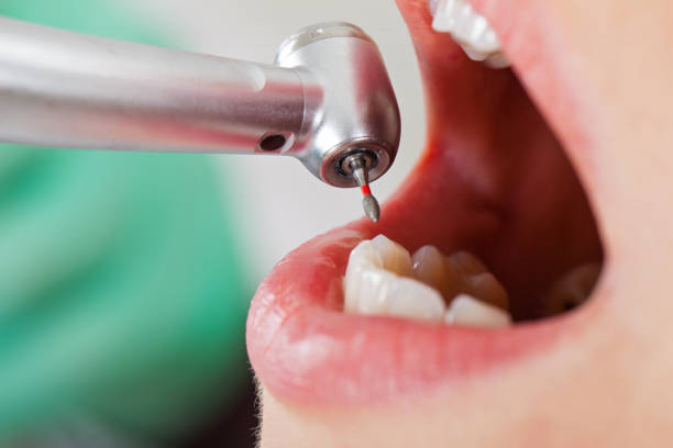 Best Emergency Dental Care for Trauma or Injury in Stanton, MI